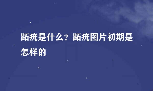 跖疣是什么？跖疣图片初期是怎样的