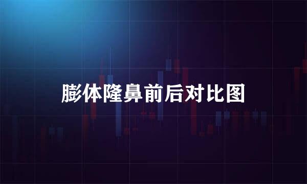 膨体隆鼻前后对比图