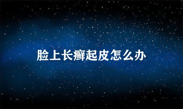 脸上长癣起皮怎么办
