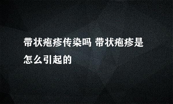 带状疱疹传染吗 带状疱疹是怎么引起的