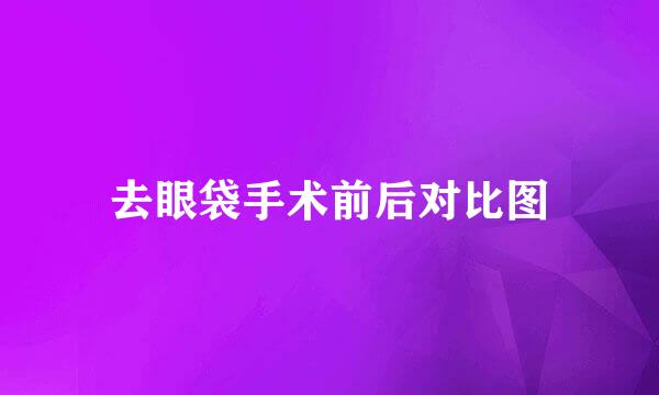 去眼袋手术前后对比图