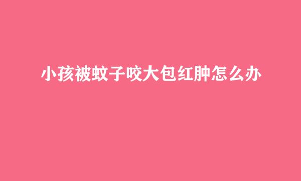 小孩被蚊子咬大包红肿怎么办