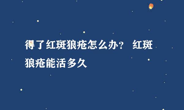 得了红斑狼疮怎么办？ 红斑狼疮能活多久